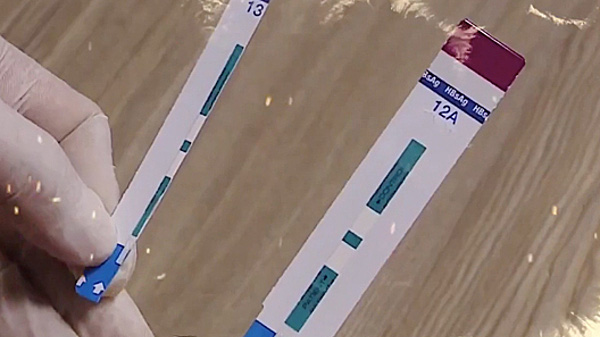 Test xét nghiệm nhanh bị nhân viên Bệnh viện  đa khoa Xanh Pôn cắt đôi để dùng cho 2 bệnh nhân.Ảnh minh họa. 