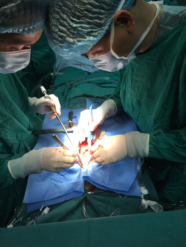 Ca phẫu thuật 8 giờ đồng hồ cứu sống bệnh nhân sốc tim nguy kịch - Ảnh 1.