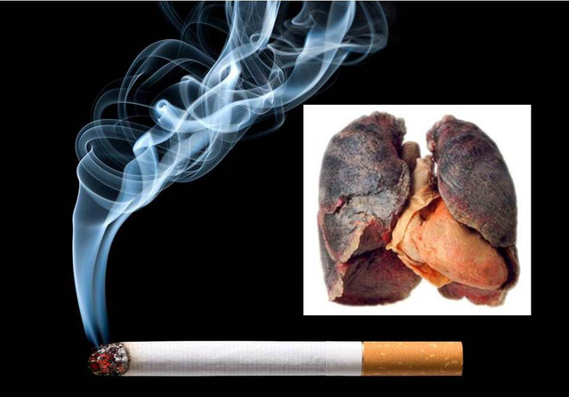 Hút một điếu thuốc giảm đi 6 phút cuộc sống - Ảnh 1.
