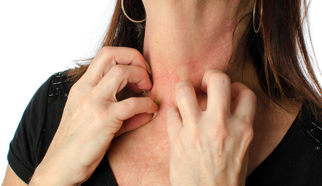 Bệnh dị ứng: cách phòng ngừa và điều trị - Ảnh 1.