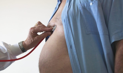 Mỡ nội tạng và mỡ dưới da: Đâu là chất béo không lành mạnh?