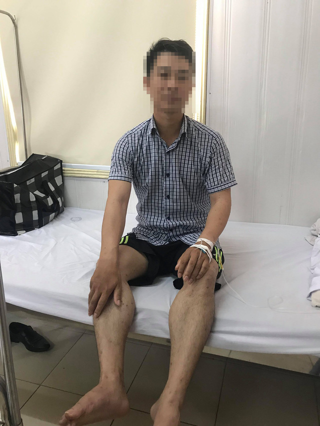 U vàng phát ban do tăng triglycerid máu - Ảnh 2.