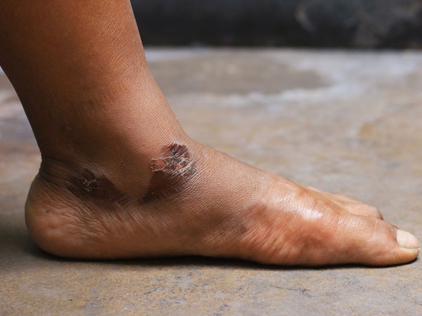 Nước chanh nghệ giúp ngăn ngừa bệnh Alzheimer, trầm cảm, ung thư và nhiều hơn nữa - Ảnh 6.