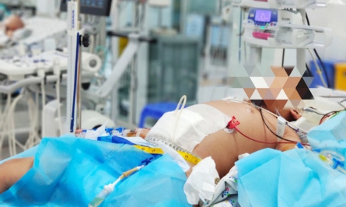 Cứu sống bệnh nhi cô đặc máu vì sốt xuất huyết