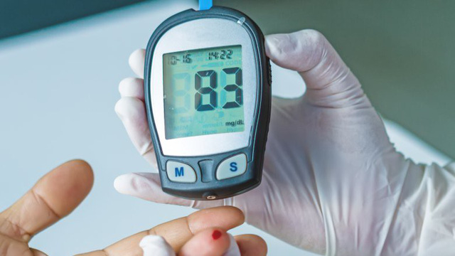 Những lưu ý khi bạn giảm cân bằng chế độ ăn keto - Ảnh 3.