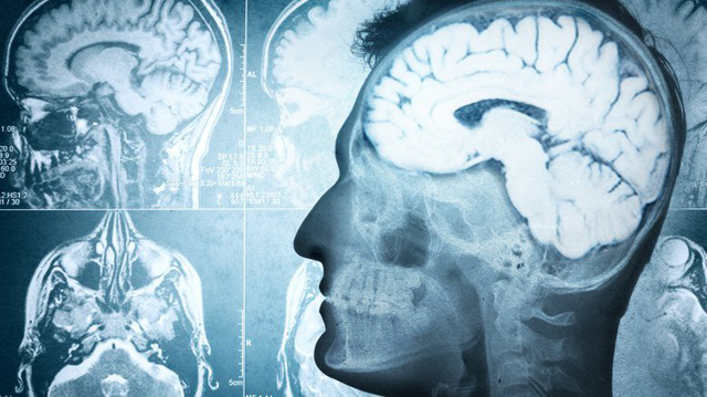 Những lưu ý khi bạn giảm cân bằng chế độ ăn keto - Ảnh 4.