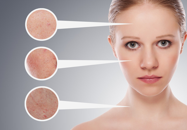 Để điều trị tận gốc làn da nám sạm - Ảnh 1.
