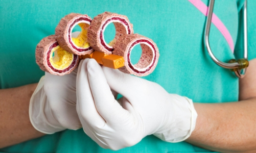 Báo động tỷ lệ người Việt Nam thừa cholesterol