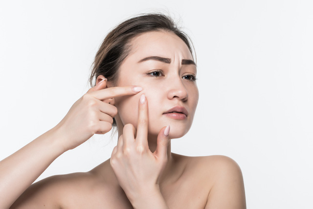3 bí quyết khắc phục làn da lỗ chân lông to do lão hóa - Ảnh 1.