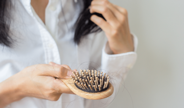 8 lý do hàng đầu gây rụng tóc - Ảnh 2.