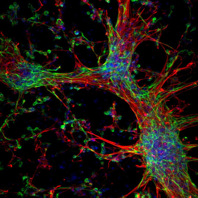 Úc giới thiệu loại gel từ tế bào gốc giúp điều trị tổn thương não bộ - Ảnh 2.