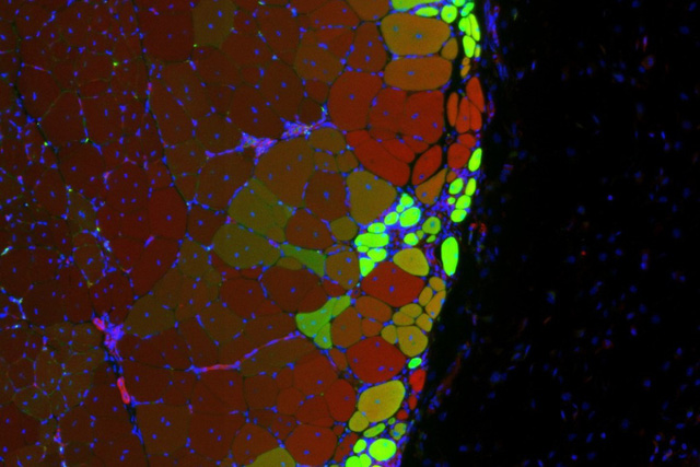Úc giới thiệu loại gel từ tế bào gốc giúp điều trị tổn thương não bộ - Ảnh 3.