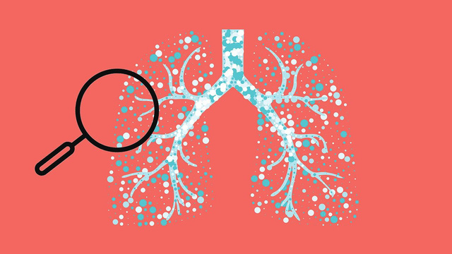 Hen phế quản dễ tái phát lúc giao mùa - Ảnh 1.