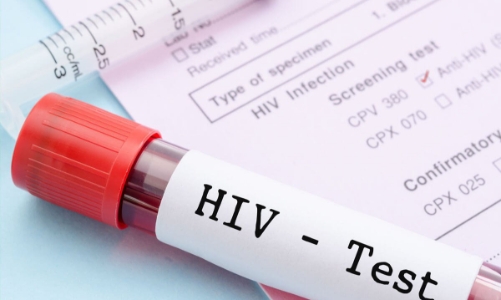 Xác định nhóm nguy cơ chính của dịch HIV tại Việt Nam