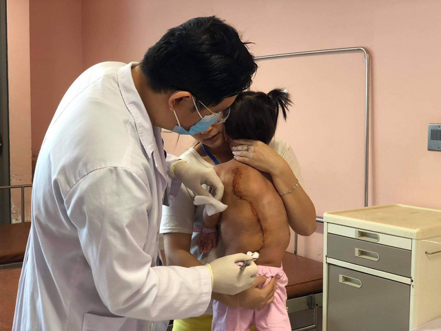 Loại bỏ khối u mỡ khổng lồ cho bé gái 2 tuổi - Ảnh 2.