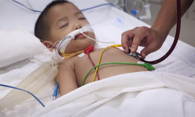 Cứu sống bé trai nguy kịch do biến chứng tay chân miệng - Ảnh 2.
