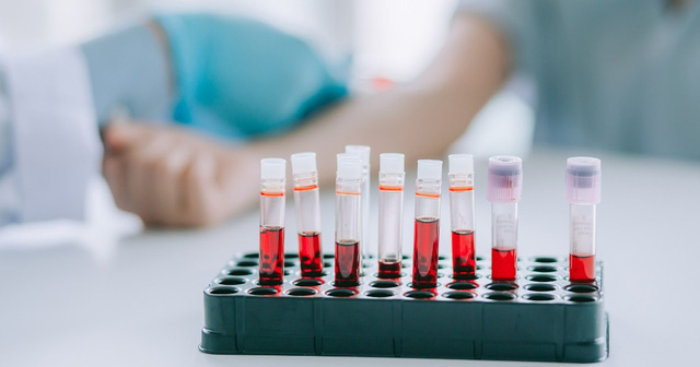 9 xét nghiệm nên làm khi khám sức khỏe tiền hôn nhân - Ảnh 2.