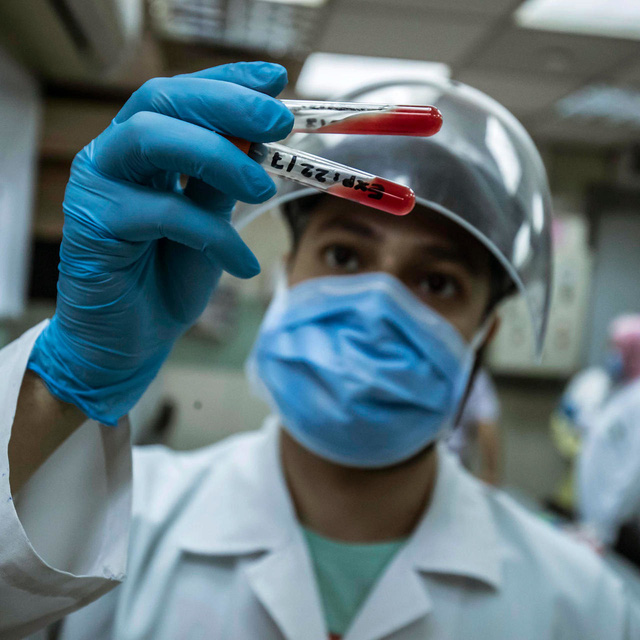 Covid-19: người không có triệu chứng sẽ mất kháng thể nhanh hơn - Ảnh 2.