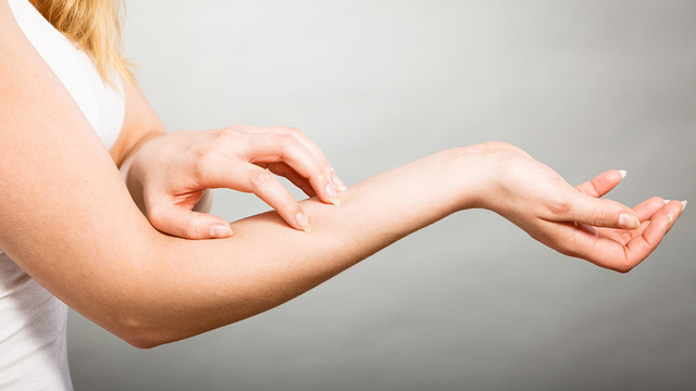 Những tín hiệu kêu cứu của làn da khô - Ảnh 2.