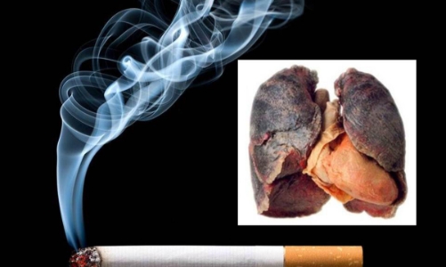 Hút một điếu thuốc giảm đi 6 phút cuộc sống