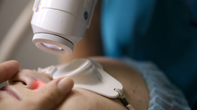 Cẩn trọng khi trị mụn, nám bằng tia laser - Ảnh 2.