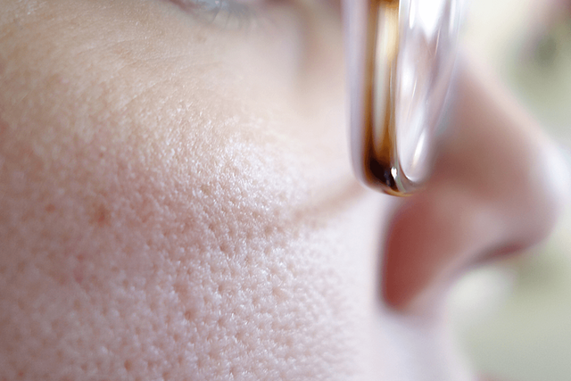 Giải pháp cho làn da láng mịn - Ảnh 1.