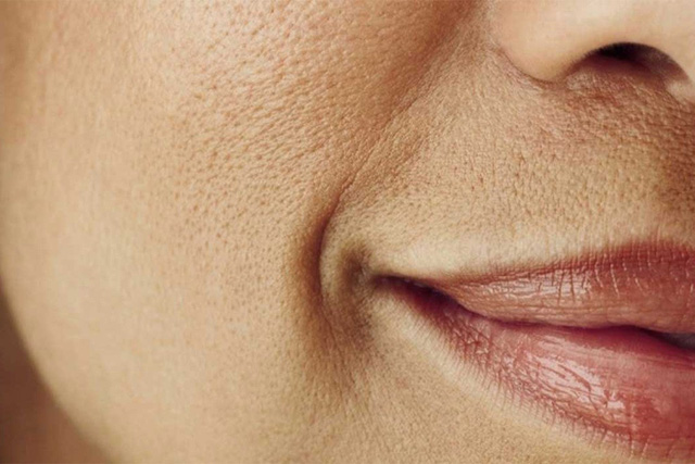 Giải pháp cho làn da láng mịn - Ảnh 2.