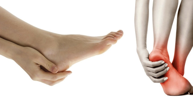 Nhìn bàn chân để đoán bệnh - Ảnh 3.