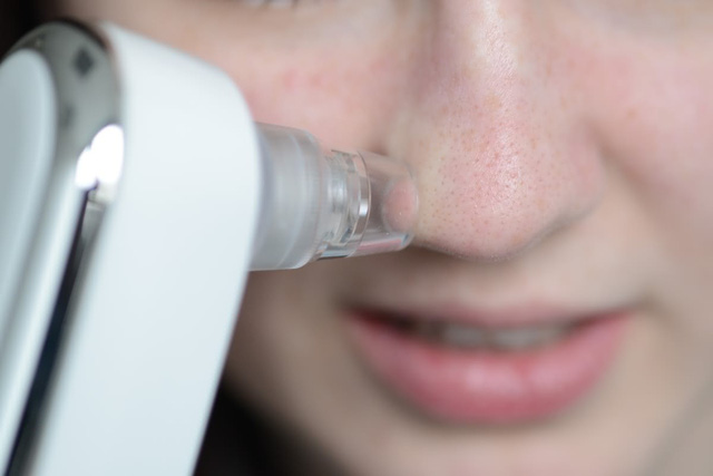 Có nên sắm máy hút mụn cầm tay? - Ảnh 2.