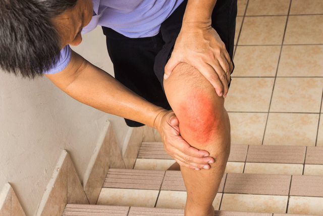 Sẽ có bọt nano giúp giảm viêm khớp? - Ảnh 3.