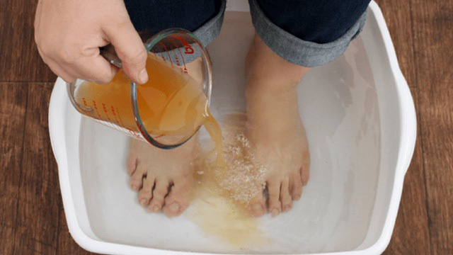 Những lợi ích của dấm hoa quả - Ảnh 3.