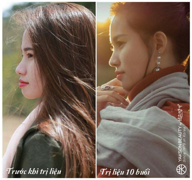 Bất ngờ với liệu pháp làm đẹp cổ truyền Hàn Quốc Golki - Ảnh 2.