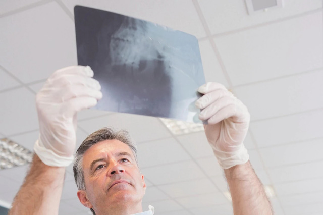 Ung thư đường tiêu hóa có liên quan tới sức khỏe răng miệng - Ảnh 2.