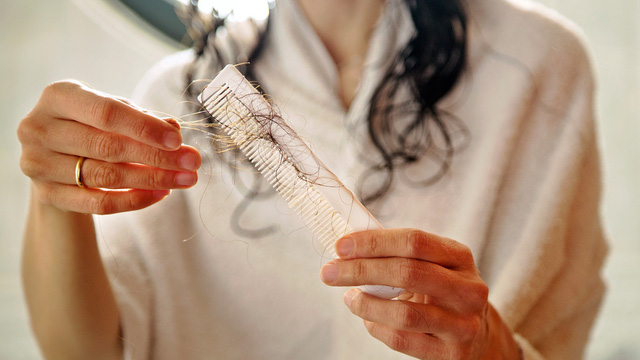 Rụng tóc sau sinh: Nguyên nhân do căng thẳng? - Ảnh 2.