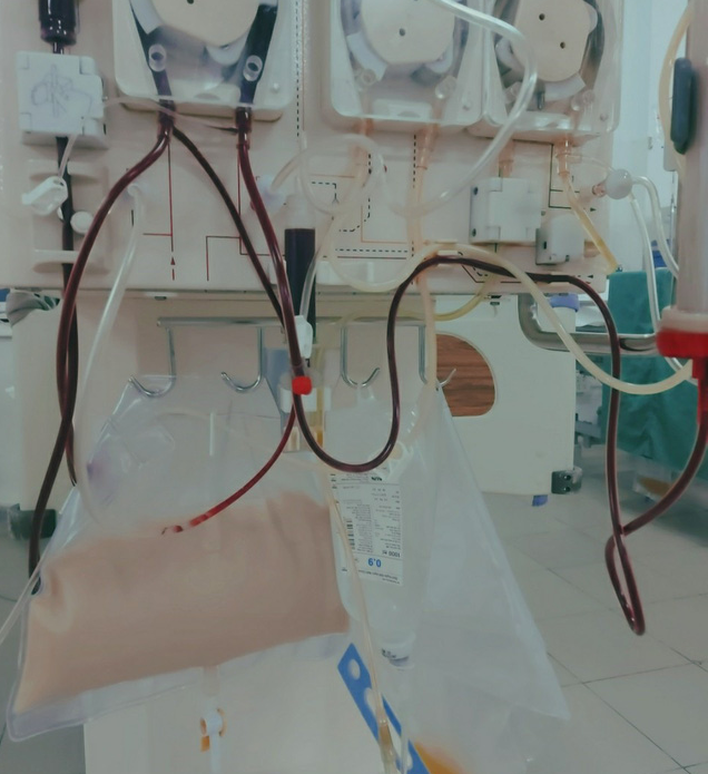 Sản phụ suy đa tạng được cứu sống nhờ lọc máu - Ảnh 1.