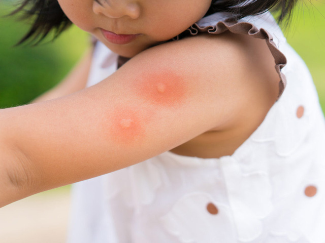 Những sai lầm trong phòng và điều trị bệnh truyền nhiễm - Ảnh 2.