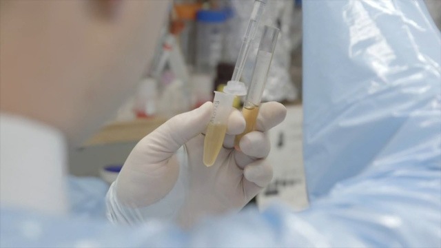 Thực hư việc cấy tế bào gốc làm đẹp - Ảnh 2.