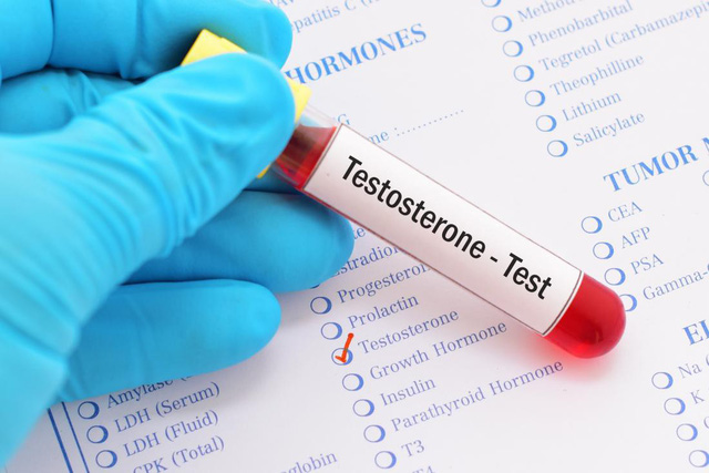 Cẩn trọng với tác dụng phụ của liệu pháp testosterone - Ảnh 2.