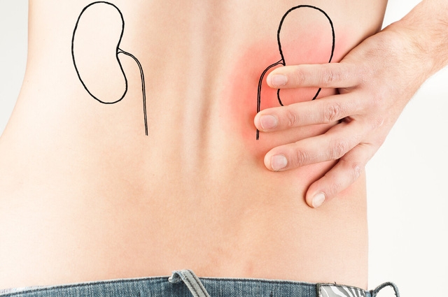 Bệnh thận mạn tính có thể gia tăng trên toàn cầu do Covid-19 - Ảnh 2.