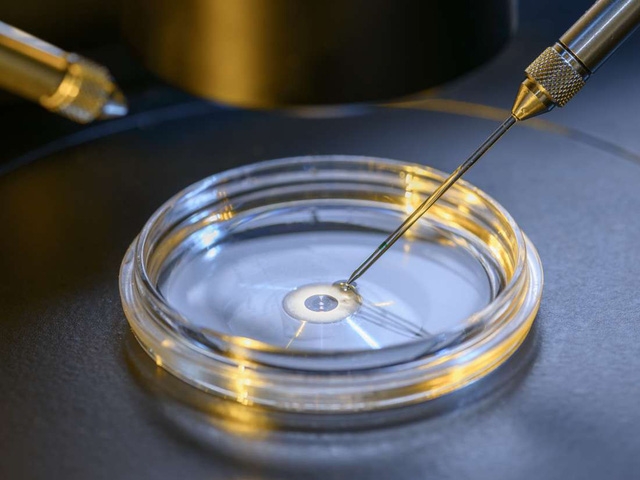 Công nghệ Time-lapse giúp tăng hiệu quả thụ tinh ống nghiệm - Ảnh 1.