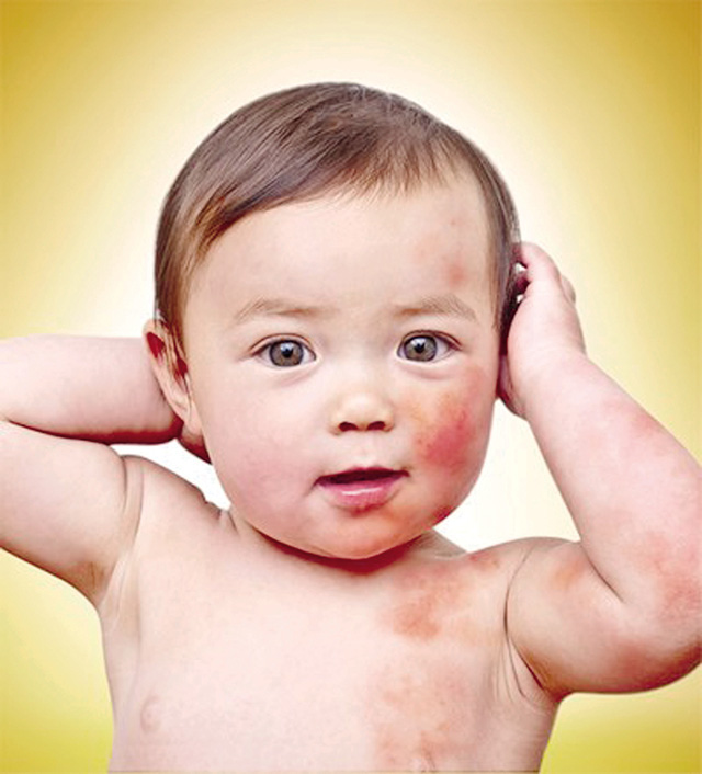 Giúp trẻ phòng tránh 7 bệnh thường gặp khi thời tiết giao mùa - Ảnh 2.