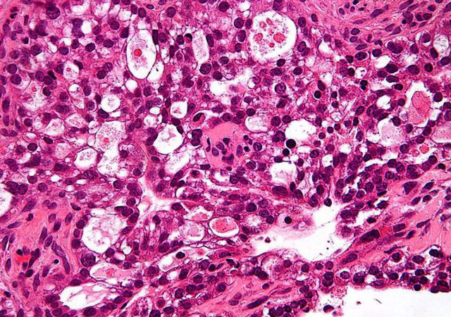 Viên thuốc con ngựa thành Troy của y học tương lai - Ảnh 2.