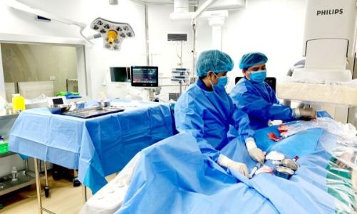 Điều trị ung thư gan bằng phương pháp nút tắc mạch