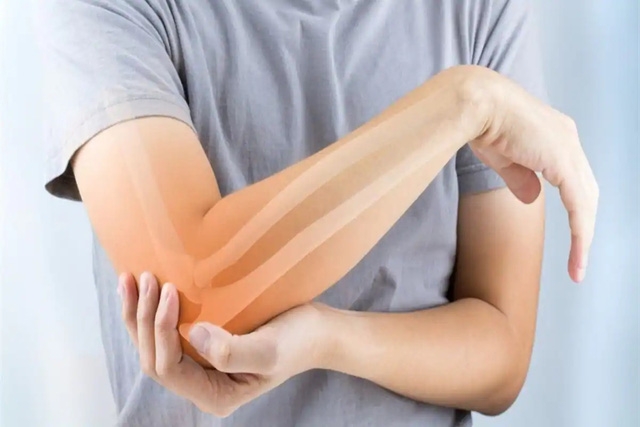 Bệnh nhân sỏi thận nên đi kiểm tra loãng xương - Ảnh 2.