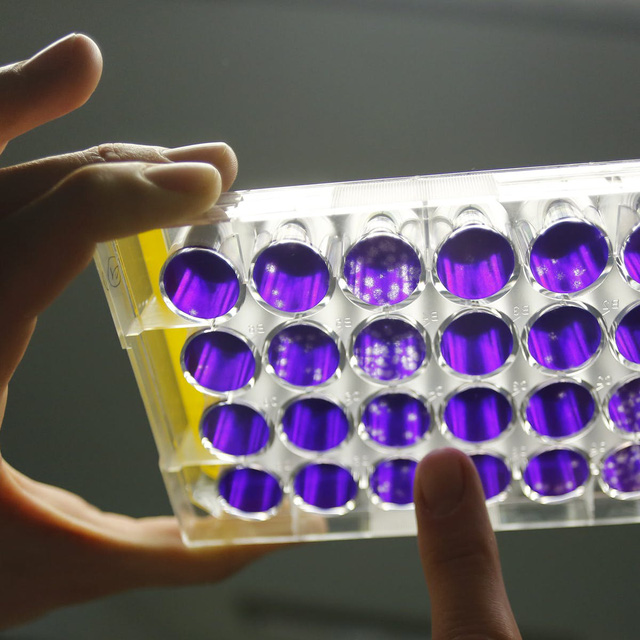 Bộ Y tế họp khẩn để ứng phó với virus viêm phổi từ Trung Quốc - Ảnh 1.