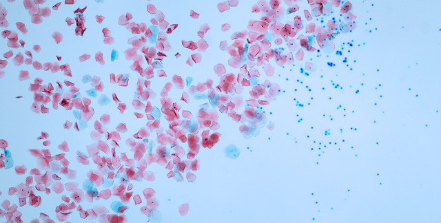 Hạt vi nhựa đã bay đến tận Bắc Cực - Ảnh 4.