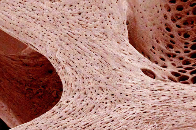 Vật liệu sinh học mới giúp điều trị loãng xương - Ảnh 2.