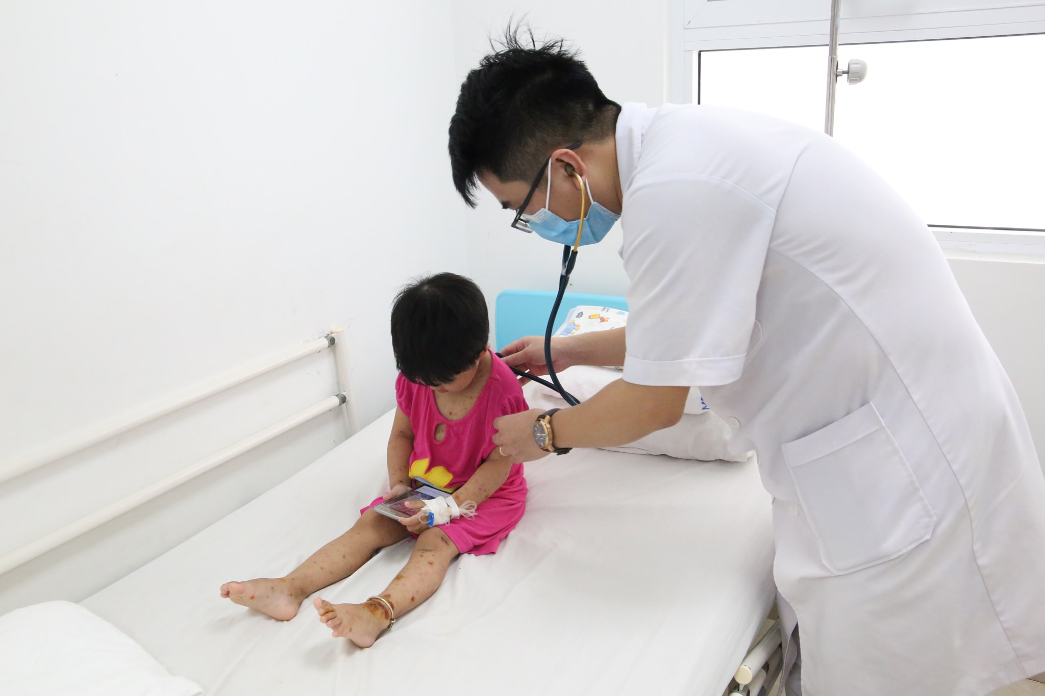 Bé Phan Như Q được chẩn đoán mắc thủy đậu bội nhiễm đồng thời có chỉ định theo dõi nhiễm trùng huyết