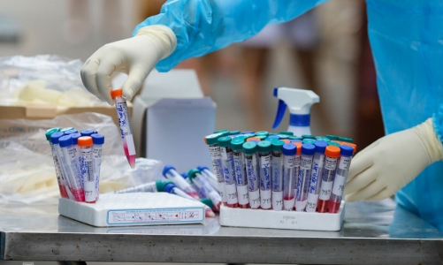 Xác định biến thể SARS-CoV-2 trên bệnh nhân ở Hà Nội, Hải Dương