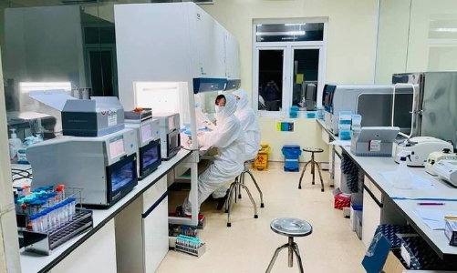 Rà soát lại toàn bộ quy trình thực hiện xét nghiệm SARS-CoV-2 đơn lẻ 
